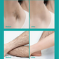 ❤️Limited-time aanbieding: 50%~69% korting op de prijs🔥Painless Full Body Hair Removal Cream voor mannen & vrouwen- Huidvriendelijk voor alle gebieden🌿
